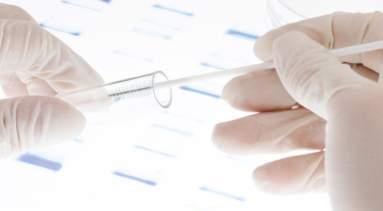 BRCA1 e BRCA2 BRCA1 e BRCA2