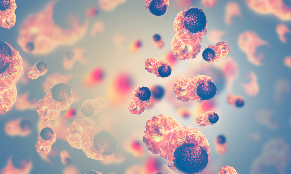 Células cancerosas em visão microscópica