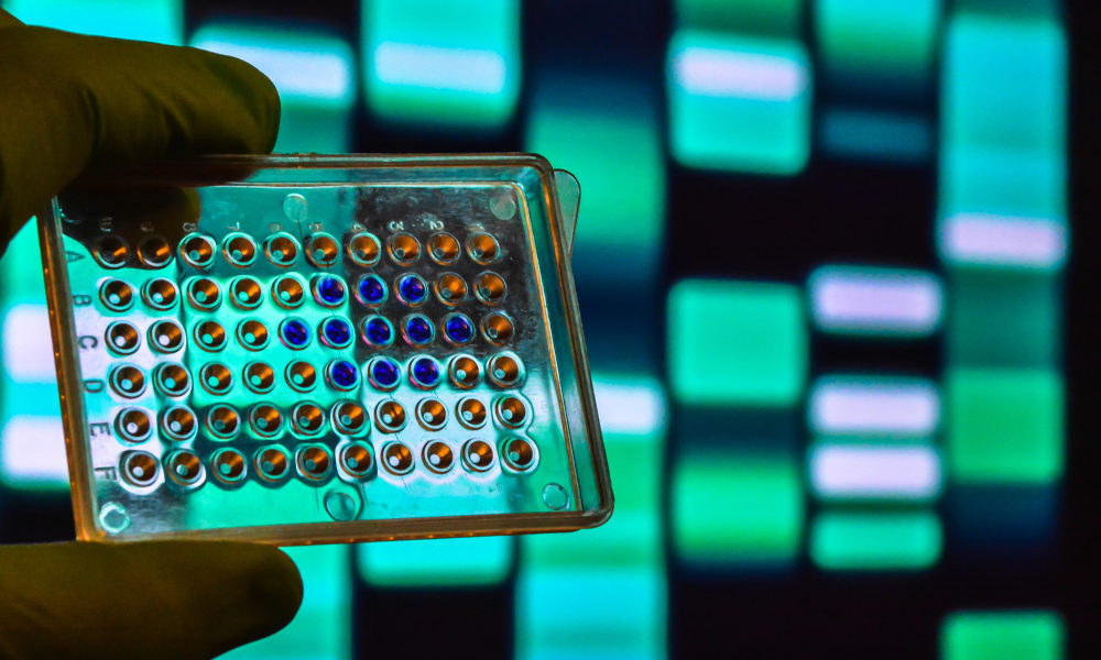 Médico segura amostra coletada para mapeamento genético